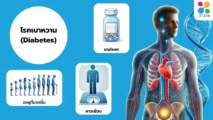 โรคเบาหวาน (Diabetes)